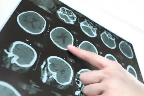 Diferența dintre tomografie și RMN văzută pe imagini