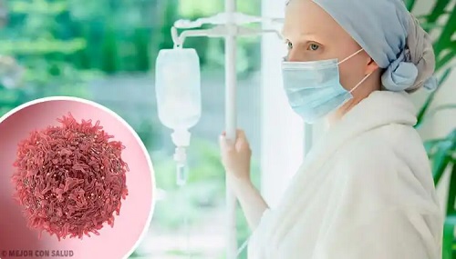 Femeie bolnavă de Ziua Mondială a Cancerului