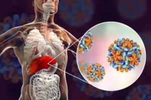 Hepatita la copii: cauze și simptome