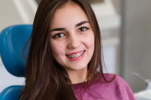 Mușcătură deschisă la adolescenți