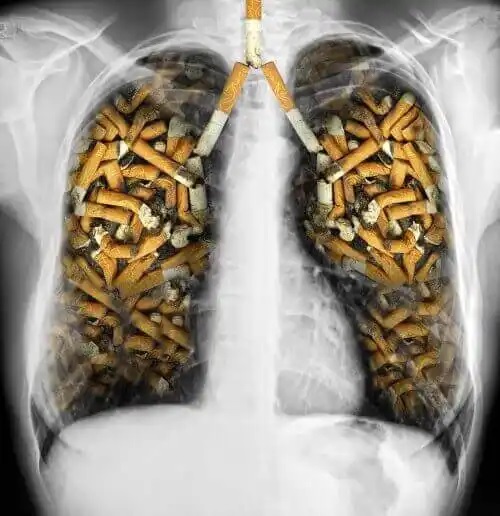 Plămâni de fumător