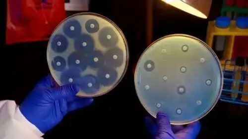 Specialist care știe cum să previi rezistența antimicrobiană