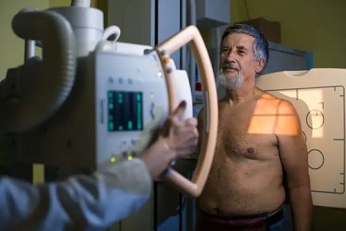 Bărbat la radiografie