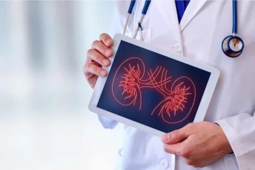 Medic care ține în mână un desen cu rinichi