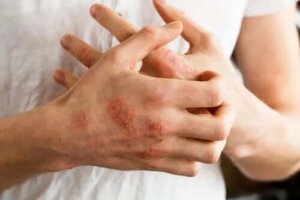 Unguentul Protopic pentru dermatita atopică