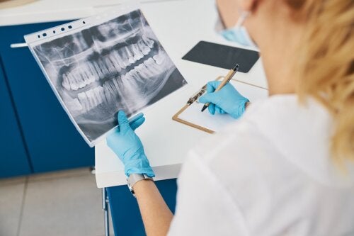 Ce tipuri de radiografii dentare există?