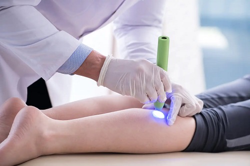 Medic care explică ce este SculpSure