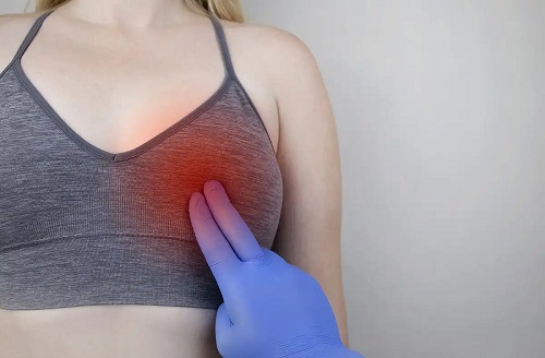 Medic ce analizează tipurile de mastită