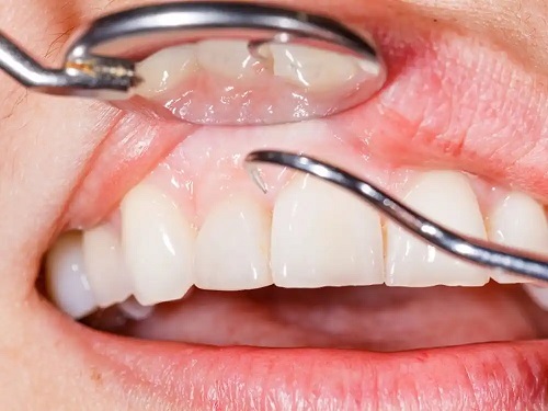 Tratament dentar la stomatolog