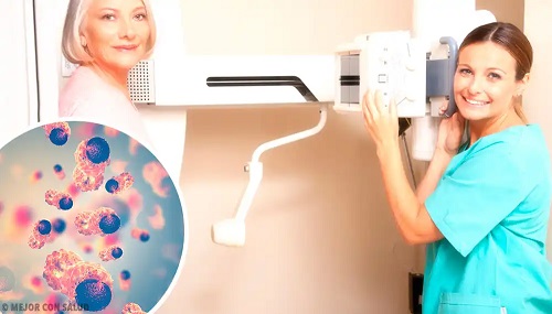 Procedura de mamografie