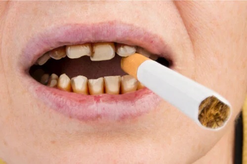 Cum afectează tutunul sănătatea dinților?