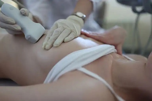 Sfaturi pentru prevenirea și detectarea chisturilor mamare