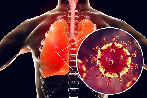 Infecție la plămâni
