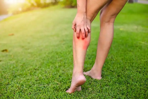 10 sfaturi pentru îngrijirea pielii cu urticarie cronică vara