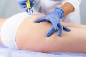 Injecția Aqualix pentru scăderea în greutate: cât de sigură este?