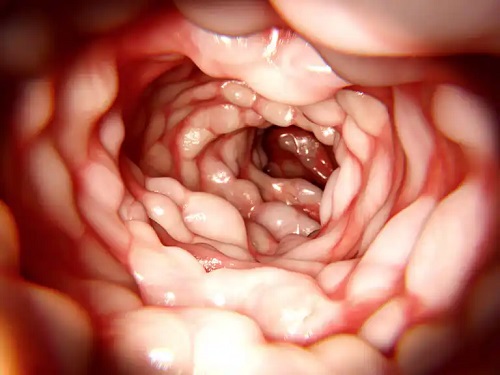 Interiorul unui intestin