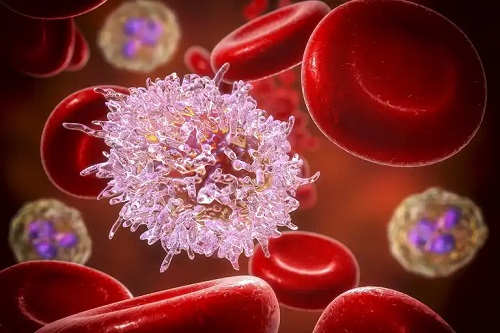 Leucemia afectează sângele