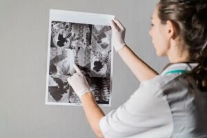 Perforația gastrointestinală: cauze, simptome și tratamente