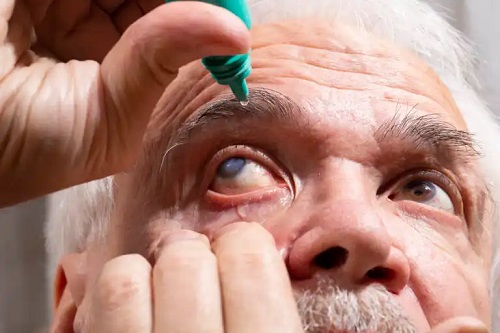Ce este pilocarpina oftalmică și când este recomandată?