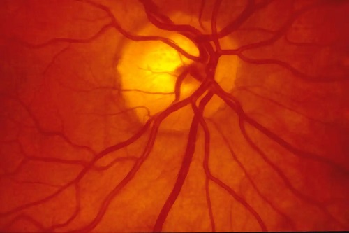 Retina ochiului uman