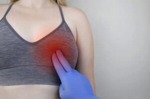 Chisturile la sâni: ce înseamnă?