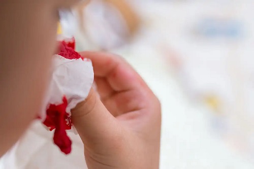 Persoană care are o sângerare nazală