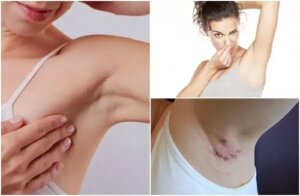 5 moduri în care axilele trimit semnale despre sănătate