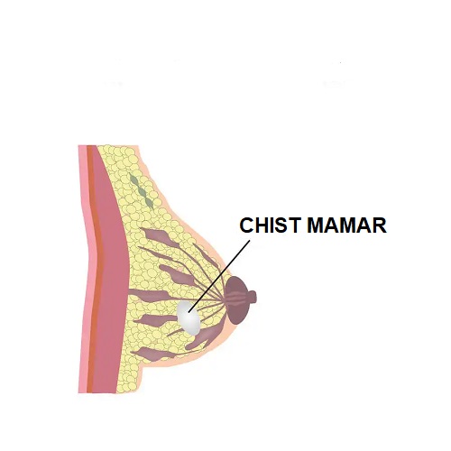 Chist mamar