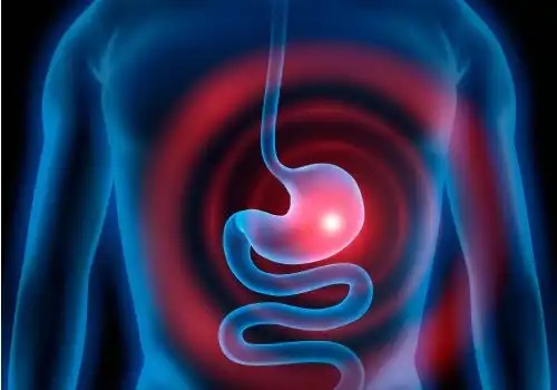 Persoană cu gastrită