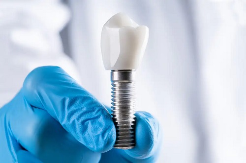 Implant dentar
