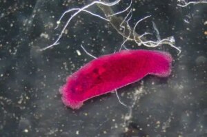 7 remedii naturiste pentru eliminarea paraziților intestinali