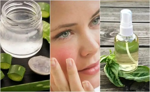 Top 5 remedii naturale pentru a calma pielea iritată