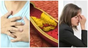 10 simptome ale colesterolului ridicat pe care nu trebuie să le ignori