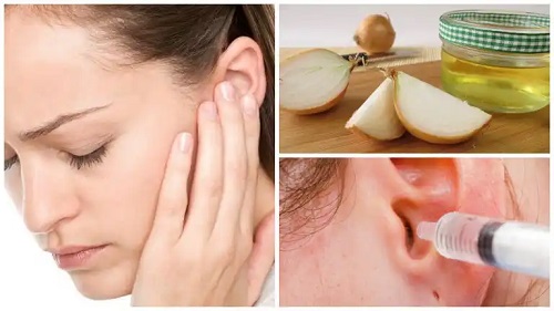8 soluții naturale pentru otită sau inflamația urechilor