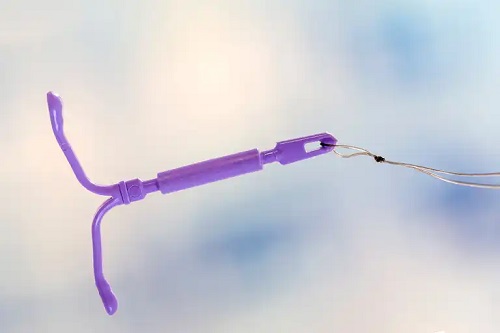 Ce este dispozitivul intrauterin