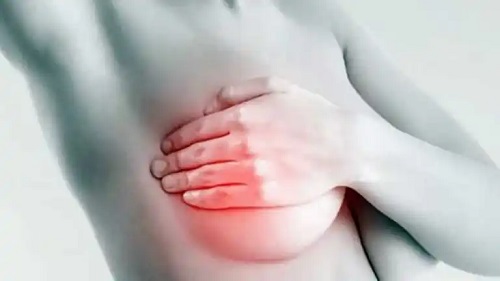 Femeie cu durere de sâni