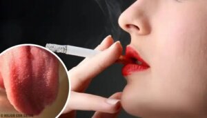 De ce apare inflamația papilelor gustative?
