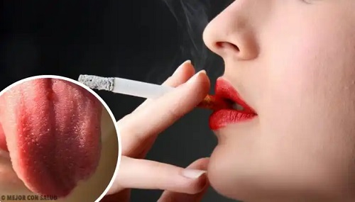 De ce apare inflamația papilelor gustative?