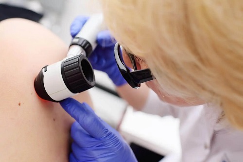 Medic ce cunoaște noutăți în dermatologie