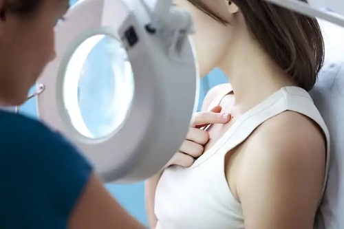 Medic ce aplică tratamente pentru eliminarea verucilor plate