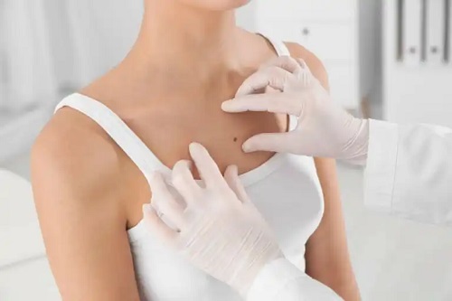Noutăți în dermatologie în 2022