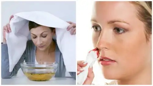 Tratamente utile când îți sângerează des nasul