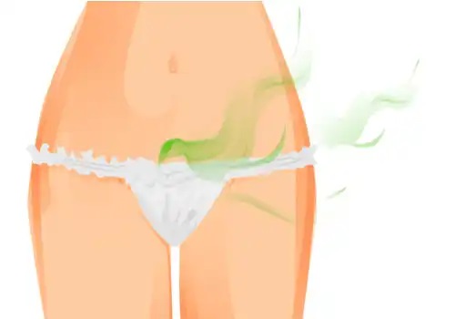 Mirosul urât arată că vaginul tău nu este sănătos