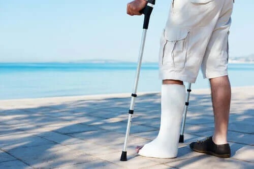 Bărbat cu piciorul în gips