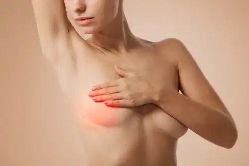 6 remedii naturale pentru mastită