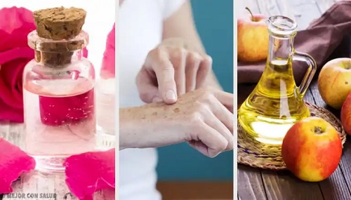 8 remedii naturiste pentru petele mâinilor