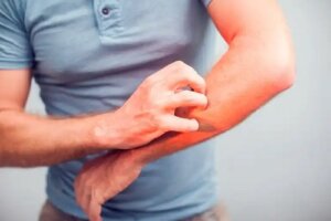 5 remedii naturiste pentru prurit sau mâncărimi