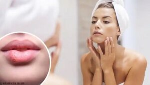 13 semne pe față care reflectă bolile