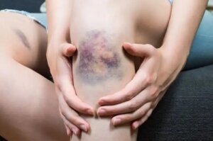 10 simptome ale cancerului pe care mulți le ignoră