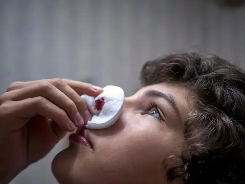 Sângerarea pe lista de simptome ale lipsei de vitamina K